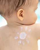 Baby with sunscreen applied on the back.